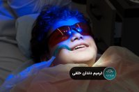 ترمیم دندان خلفی