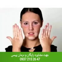 پیسی درمان دارد ؟؟