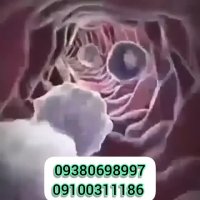 داروهای درمان قطعی بیماری پسوریازیس و زخم های پوستی