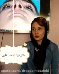 جراحی زیبایی بینی