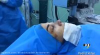 نحوه جراحی بینی