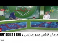 درمان قطعی پسوریازیس و صدف کشف شد