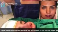 فیلم لحظه جراحی بینی