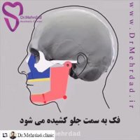 از دست دادن دندان