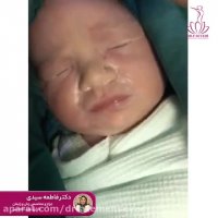 فیلم عمل زایمان سزارین