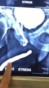 جراحی مجاری ادرار