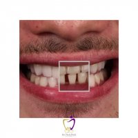 لبخند زیبای یکی دیگر از مراجعه کنندگان عزیزمون