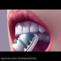 آموزش مسواک زدن