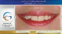 دکتر داودیان | متخصص ارتودنسی