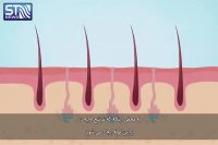 چرا عرق می کنیم ؟