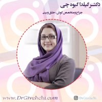 طراحی فرم بینی قبل از عمل جراحی