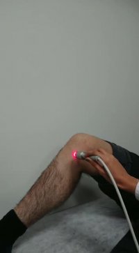 لیزر پرتوان و کاهش سریع درد زانو