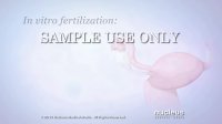 In Vitro Fertilization (IVF)