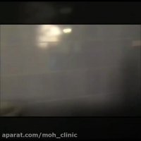 جراحی اندوسکوپیک تومور سینوس