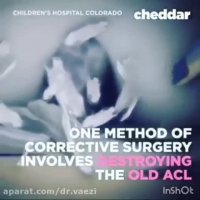 جراحی تعویض رباط صلیبی