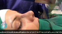 نمونه جراحی بینی به روش بسته