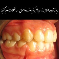 بهترین متخصص ارتودنسی کسی هست که بتونه ارتودنسی با ثبات ارایه بده