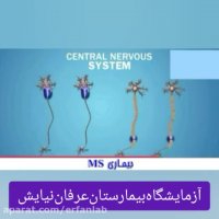 بیماری ام اس را بهتر بشناسیم