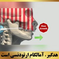 ارتودنسی شمال تهران | متخصص ارتودنسی