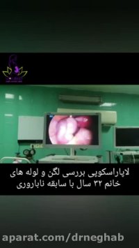 لاپاراسکوپی لگن