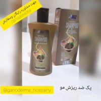 درمان ریزش مو درخانه