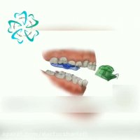 ارتودنسی متحرک