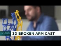 قالب مشبک ساده و چاپگر سه بعدی- جایگزین گچ شکسته بندی