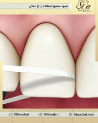 نخ دندان | دندانپزشکی سیمادنت