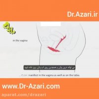 دلایل عفونت های واژینال