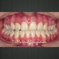 دکتر داودیان | متخصص ارتودنسی