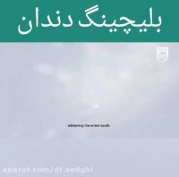 فیلم بلیچینگ دندان 2