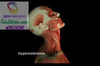 کاردرمانی درکرج  09121623463  عظیمیه خیابان طالقانی گلستان21