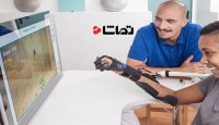 دستکش هوشمند برای بیماران با ضعف حرکتی