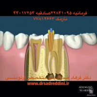 عصب کشی دندان و ارتودنسی