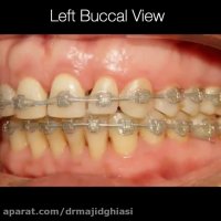 ارتودنسی دندان-دکترمجیدقیاسی دندانپزشک زیبایی مشهد