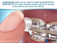 اورژانس های ارتودنسی | دکتر مسعود داوودیان