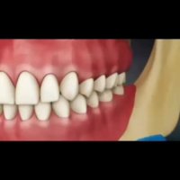 نحوه صحیح مسواک زدن