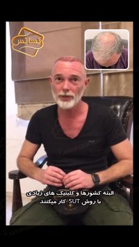 کاشت مو کلینیک تخصصی رنسانس