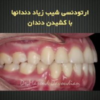 بهترین دکتر ارتودونسی تهران | دکتر داوودیان