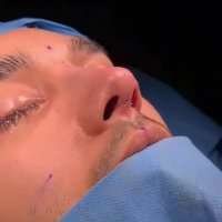 عمل بینی مشهد | ویزیت 09380000893