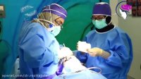 فیلم واقعی جراحی سپتورینوپلاستی خانمی 27 ساله