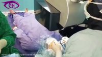 فیلم واقعی جراحی لازک چشم