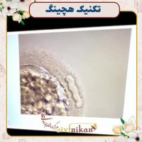 فیلم هچینگ جنین با لیزر