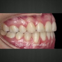 ارتودونسی شرق تهران | دکتر داوودیان