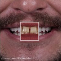 لبخند مراجعه کننده عزیز بعد از انجام کار زیبایی