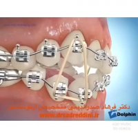 متخصص ارتودنسی در غرب تهران