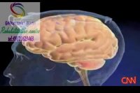 بهترین مرکز نوروفیدبک در البرز 09121623463|عظیمیه میدان بهارستان خیابان لاله 2