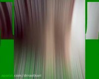 نمونه جراحی بینی دکتر راستکاری