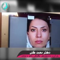 شش سال بعد از عمل بینی | دکتر گلی