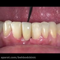 بریج مریلند